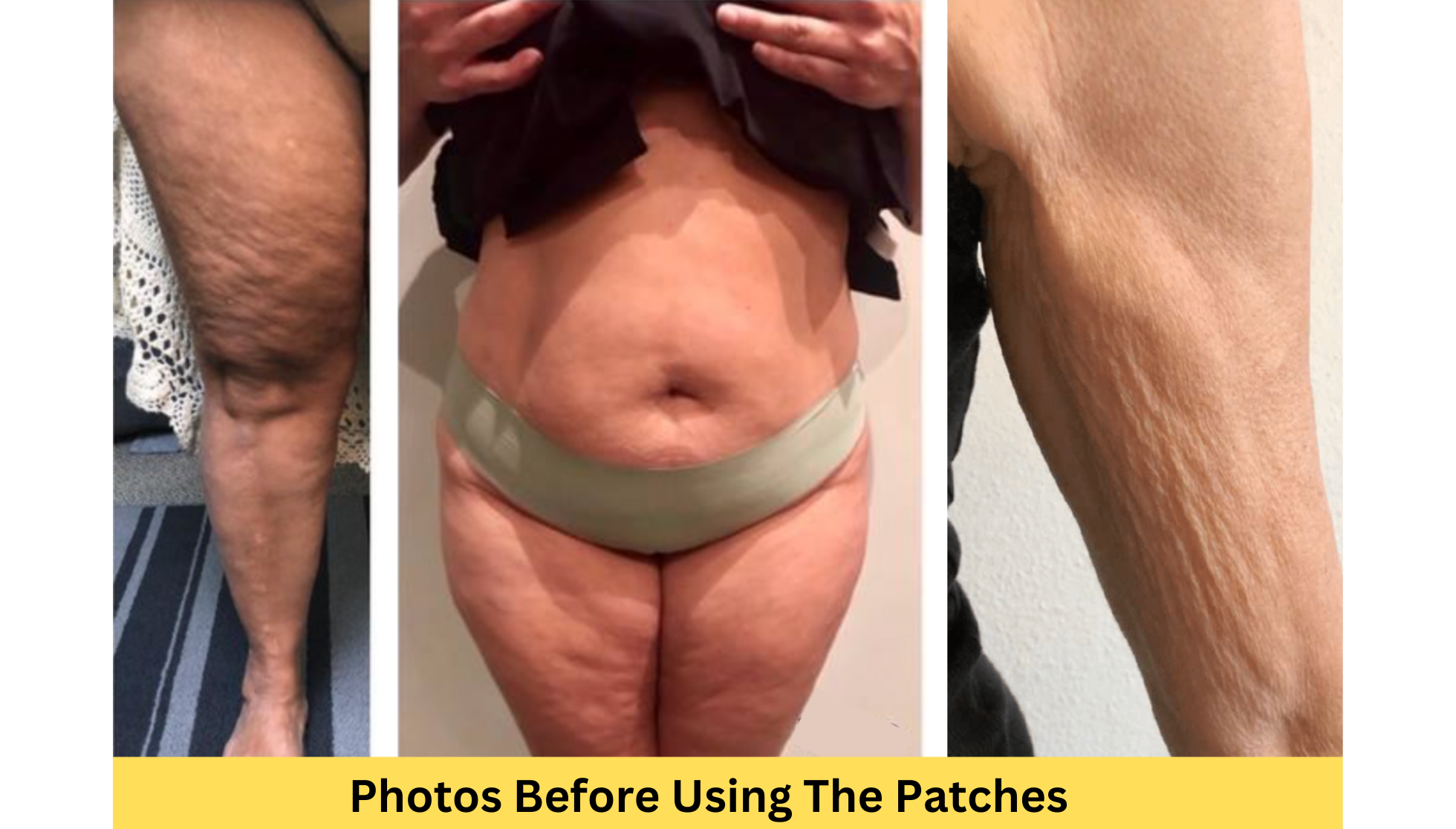 Photos Before Using The Formula Photos Before Using The Formula