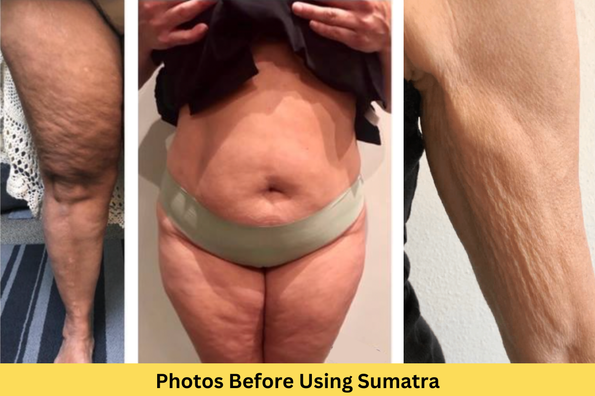 Outbrain 1200X800 (7) Outbrain 1200X800 (7)