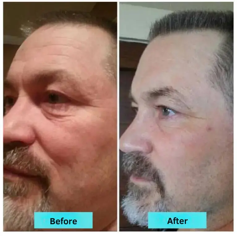 before.png before.png